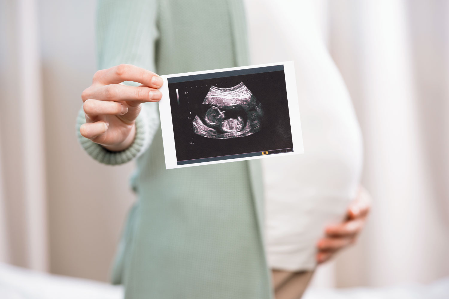 Ultrasound prenatal hyperechoiclung lesions